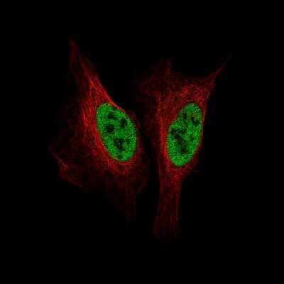 Immunocytochemistry/ Immunofluorescence SMCHD1 Antibody (CL4270) - BSA Free