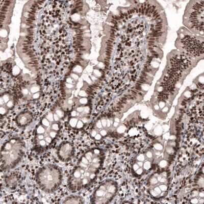 Immunohistochemistry SMCHD1 Antibody (CL4270) - BSA Free