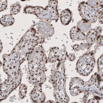 Immunohistochemistry SMCHD1 Antibody (CL4270) - BSA Free