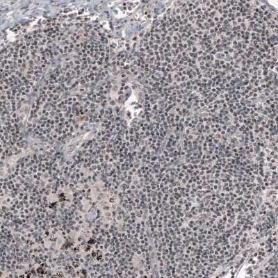 Immunohistochemistry SMCHD1 Antibody (CL4270) - BSA Free