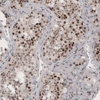 Immunohistochemistry-Paraffin SMCHD1 Antibody (CL4270) - BSA Free