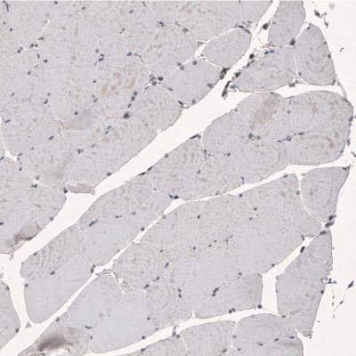 Immunohistochemistry-Paraffin SMCHD1 Antibody (CL4270) - BSA Free