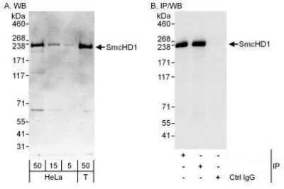 Western Blot: SMCHD1 Antibody [NBP1-49969] - Detection of Human SmcHD1 by Western Blot and Immunoprecipitation.  Samples:  Whole cell lysate from HeLa (5, 15 and 50 mcg for WB; 1 mg for IP, 20% of IP loaded) and 293T (T; 50 mcg) cells.  Antibodies: Affinity purified rabbit anti-SmcHD1 antibody used for WB at 0.04 mcg/ml (A) and 0.4 mcg/ml (B) and used for IP at 3 mcg/mg lysate.  SmcHD1 was also immunoprecipitated by rabbit anti-SmcHD1 antibody which recognizes an upstream epitope.  For blotting immunoprecipitated SmcHD1 was used.  Detection: Chemiluminescence with exposure times of 3 minutes (A) and 3 seconds (B).