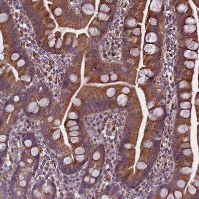 Immunohistochemistry-Paraffin: SMCR7 Antibody [NBP1-81165] - Staining of human small intestine shows moderate cytoplasmic positivity in glandular cells.