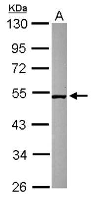 Western Blot: SMCR7 Antibody [NBP2-20421] - Sample (30 ug of whole cell lysate) A: Raji 10% SDS PAGE gel, diluted at 1:500.