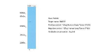 Western Blot: SMCR7 Antibody [NBP2-85778] - Host: Rabbit. Target: SMCR7. Positive control (+): Human Ovary Tumor (T-OV). Negative control (-): Human Lung Tumor (T-LU). Antibody concentration: 3ug/ml