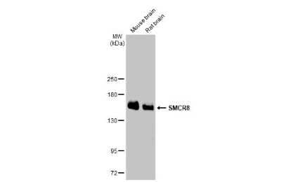 Western Blot: SMCR8 Antibody (HL1007) [NBP3-13677] - Various tissue extracts (50 ug) were separated by 5% SDS-PAGE, and the membrane was blotted with SMCR8 antibody [HL1007] (NBP3-13677) diluted at 1:1000. The HRP-conjugated anti-rabbit IgG antibody (NBP2-19301) was used to detect the primary antibody.