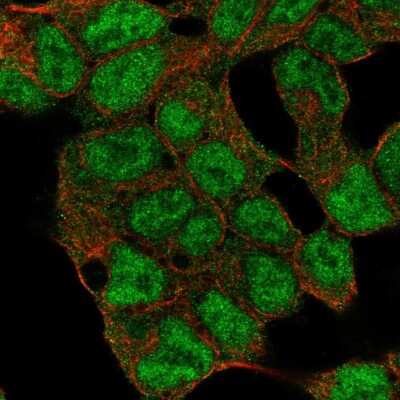 Immunocytochemistry/Immunofluorescence: SMCX Antibody [NBP2-55009] - Staining of human cell line HEK 293 shows localization to nucleoplasm & cytosol. Antibody staining is shown in green.