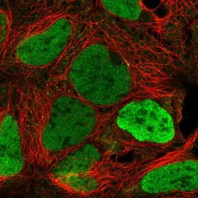 Immunocytochemistry/Immunofluorescence: SMCX Antibody [NBP2-55541] - Staining of human cell line HEK 293 shows localization to nucleoplasm.