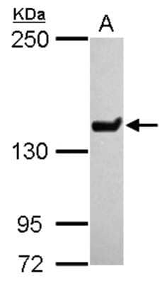 Western Blot: SMCX Antibody [NBP2-20422] - Sample (30 ug of whole cell lysate) A: IMR32 5% SDS PAGE gel, diluted at 1:10000.