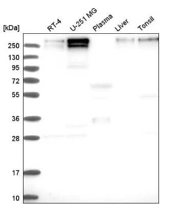 Western Blot: SMCX Antibody [NBP2-55541] - Analysis in human cell line RT-4, human cell line U-251 MG, human plasma, human liver tissue and human tonsil tissue.