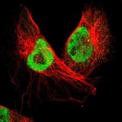 Immunocytochemistry/Immunofluorescence: SMEK2 Antibody [NBP1-83882] - Staining of human cell line U-251 MG shows localization to nucleoplasm & centrosome. Antibody staining is shown in green.