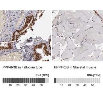 Immunohistochemistry-Paraffin: SMEK2 Antibody [NBP1-83882] - Analysis in human fallopian tube and skeletal muscle tissues using NBP1-83882 antibody. Corresponding PPP4R38 RNA-seq data are presented for the same tissues.