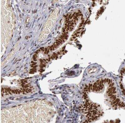 Immunohistochemistry-Paraffin SMEK2 Antibody