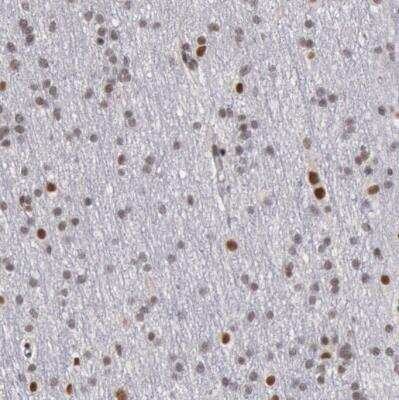 Immunohistochemistry-Paraffin SMEK2 Antibody