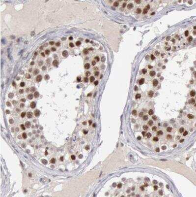 Immunohistochemistry-Paraffin SMEK2 Antibody