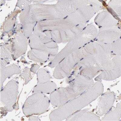 Immunohistochemistry-Paraffin: SMEK2 Antibody [NBP1-83882] - Staining of human skeletal muscle shows no positivity in myocytes as expected.