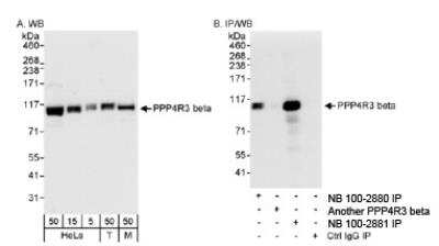 Western Blot SMEK2 Antibody