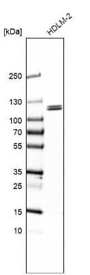 Western Blot: SMEK2 Antibody [NBP1-83882] - Analysis in human cell line HDLM-2.