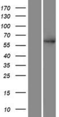 Western Blot SMEK2 Overexpression Lysate