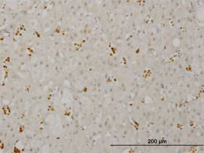 Immunohistochemistry-Paraffin: SMG1 Antibody (1C12) [H00023049-M03] - Analysis of monoclonal antibody to SMG1 on formalin-fixed paraffin-embedded human adrenal gland. Antibody concentration 1.5 ug/ml