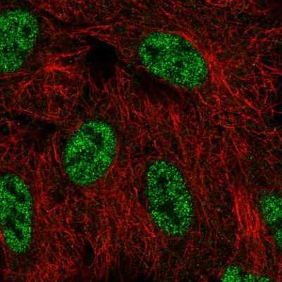 Immunocytochemistry/Immunofluorescence: SMG1 Antibody [NBP2-55889] - Staining of human cell line A549 shows localization to nucleoplasm.