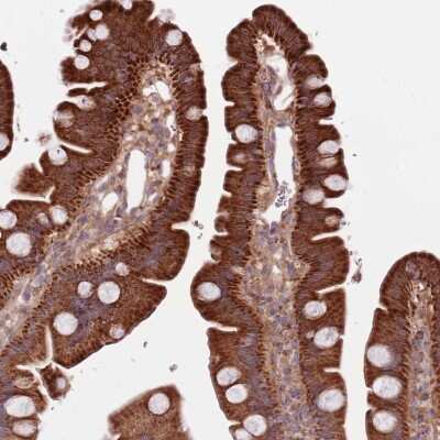 Immunohistochemistry-Paraffin: SMG1 Antibody [NBP2-37870] - Staining of human small intestine shows strong cytoplasmic positivity in glandular cells.