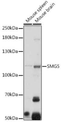 Western Blot: SMG5 Antibody [NBP3-05264] - Analysis of extracts of various cell lines, using SMG5 antibody at 1:1000 dilution. Secondary antibody: HRP Goat Anti-Rabbit IgG (H+L) at 1:10000 dilution. Lysates/proteins: 25ug per lane. Blocking buffer: 3% nonfat dry milk in TBST. Detection: ECL Basic Kit. Exposure time: 60s.