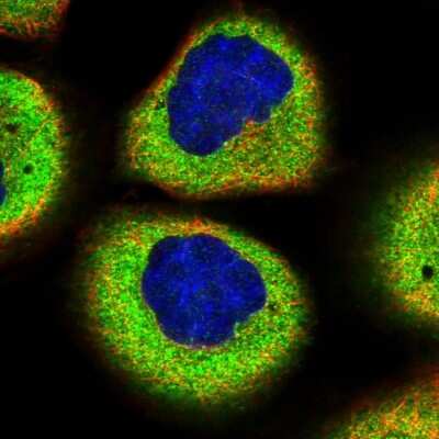 Immunocytochemistry/Immunofluorescence: SMG7 Antibody [NBP1-88486] - Immunofluorescent staining of human cell line A-431 shows localization to cytosol. Antibody staining is shown in green.