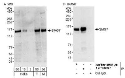 Western Blot: SMG7 Antibody [NBP1-22967] - Western Blot and Immunoprecipitation:  by Western Blot : Whole cell lysate from HeLa, 293T and mouse NIH3T3 cells. SMG7 was also immunoprecipitated byanother rabbit anti-SMG7 antibody.