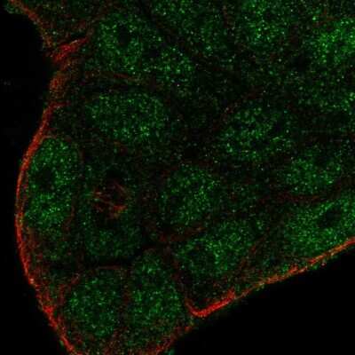 Immunocytochemistry/Immunofluorescence: SMIM22 Antibody [NBP2-57772] - Staining of human cell line RT4 shows localization to nucleoplasm & cytosol.