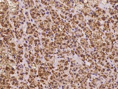Immunohistochemistry-Paraffin: SMIM4 Antibody [NBP2-98129] - Human SMIM4 Antibody in human adrenal gland with rabbit polyclonal antibody at 1:100 dilution.