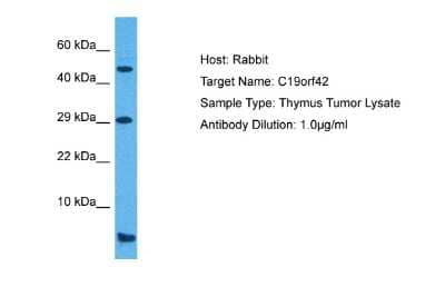 Western Blot: SMIM7 Antibody [NBP2-83565] - Host: Rabbit. Target Name: C19ORF42. Sample Tissue: Human Thymus Tumor lysates. Antibody Dilution: 1ug/ml