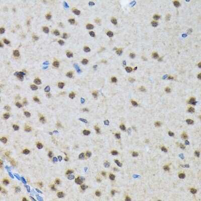 Immunohistochemistry-Paraffin: SMN Antibody (9N9Q6) [NBP3-16863] - Immunohistochemistry of paraffin-embedded rat brain using SMN Rabbit mAb (NBP3-16863) at dilution of 1:100 (40x lens).Perform microwave antigen retrieval with 10 mM Tris/EDTA buffer pH 9.0 before commencing with IHC staining protocol.