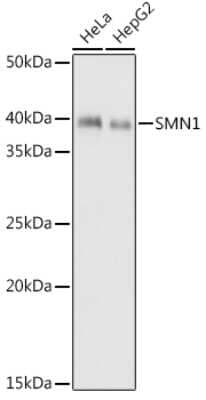 Western Blot: SMN Antibody (9N9Q6) [NBP3-16863] - Western blot analysis of extracts of various cell lines, using SMN antibody (NBP3-16863) at 1:1000 dilution. Secondary antibody: HRP Goat Anti-Rabbit IgG (H+L) at 1:10000 dilution. Lysates/proteins: 25ug per lane. Blocking buffer: 3% nonfat dry milk in TBST. Detection: ECL Basic Kit. Exposure time: 1s.