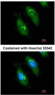 Immunocytochemistry/Immunofluorescence: SMN Antibody [NBP1-32021] - Analysis of methanol-fixed HeLa, using antibody at 1:200 dilution.