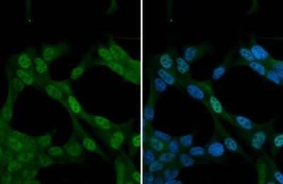 Immunocytochemistry/Immunofluorescence: SMN Antibody [NBP3-13414] - SMN antibody detects SMN protein at cytoplasm by immunofluorescent analysis. Sample: Neuro2A cells were fixed in 4% paraformaldehyde at RT for 15 min. Green: SMN stained by SMN antibody (NBP3-13414) diluted at 1:500.