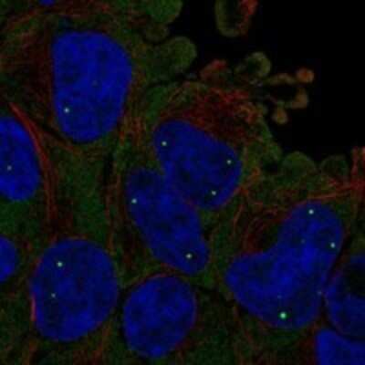 Immunocytochemistry/Immunofluorescence: SMN Antibody [NBP3-17675] - Staining of human cell line HEK 293 shows localization to nuclear bodies & cytosol.