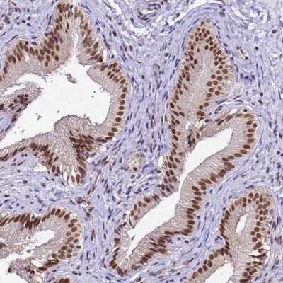 Immunohistochemistry-Paraffin: SMN Antibody [NBP2-46712] - Staining of human gallbladder shows nuclear positivity in glandular cells.