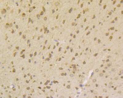 Immunohistochemistry-Paraffin: SMN Antibody (JG38-19) [NBP2-76839] - Analysis of  mouse brain tissue using anti-Gemin 1 antibody. Counter stained with hematoxylin.