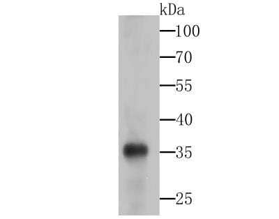 Western Blot: SMN Antibody (JG38-19) [NBP2-76839] - Western blot analysis of Gemin 1 on SiHa cell lysates using anti-Gemin 1 at 1/500 dilution.