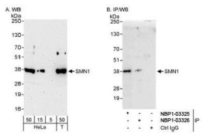 Western Blot: SMN Antibody [NBP1-03326] - Detection of Human SMN1 on HeLa whole cell lysate using NBP1-03326. SMN1 was  also immunoprecipitated by rabbit anti-SMN1 antibody NBP1-03325.