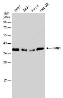 Western Blot: SMN Antibody [NBP1-32021] - Various whole cell extracts (30 ug) were separated by 12% SDS-PAGE, and the membrane was blotted with SMN1 antibody diluted at 1:1000. The HRP-conjugated anti-rabbit IgG antibody (NBP2-19301) was used to detect the primary antibody.