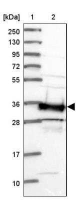 Western Blot: SMN Antibody [NBP2-46712] - Lane 1: Marker  [kDa] 250, 130, 95, 72, 55, 36, 28, 17, 10, Lane 2: Human cell line RT-4