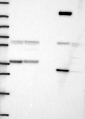 Western Blot: SMN Antibody [NBP3-17675] - Lane 1: Marker [kDa] 250, 130, 95, 72, 55, 36, 28, 17, 10;   Lane 2: RT4;   Lane 3: U-251 MG;   Lane 4: Human Plasma;   Lane 5: Liver;   Lane 6: Tonsil