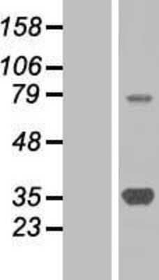 Western Blot: SMN Overexpression Lysate (Adult Normal) [NBP2-06396] Left-Empty vector transfected control cell lysate (HEK293 cell lysate); Right -Over-expression Lysate for SMN.