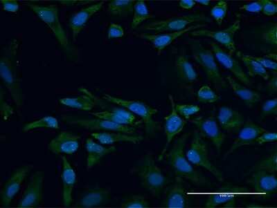 Immunocytochemistry/Immunofluorescence: SMN2 Antibody [H00006607-B01P] - Analysis of purified antibody to SMN2 on HeLa cell. (antibody concentration 10 ug/ml)
