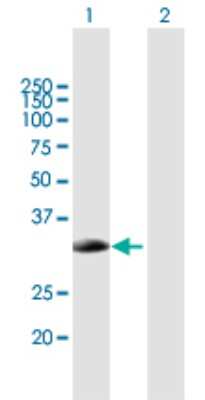 Western Blot: SMN2 Antibody [H00006607-B01P] - Analysis of SMN2 expression in transfected 293T cell line by SMN2 polyclonal antibody.  Lane 1: SMN2 transfected lysate(31.02 KDa). Lane 2: Non-transfected lysate.