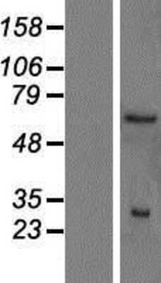 Western Blot: SMN2 Overexpression Lysate (Adult Normal) [NBP2-06378] Left-Empty vector transfected control cell lysate (HEK293 cell lysate); Right -Over-expression Lysate for SMN2.