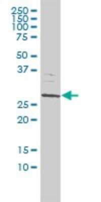 Western Blot: SMNDC1 Antibody (2B9) [H00010285-M01] - SMNDC1 monoclonal antibody (M01), clone 2B9 Analysis of SMNDC1 expression in Jurkat.